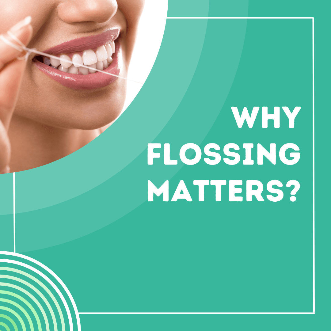 Why Flossing Matters